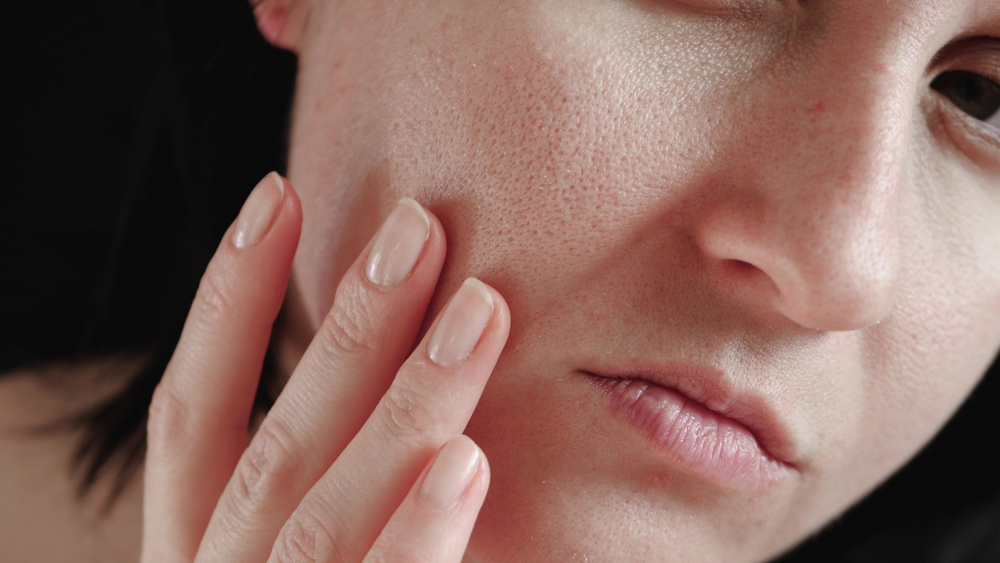 How to Tighten Skin Pores? 10 Expert Tips